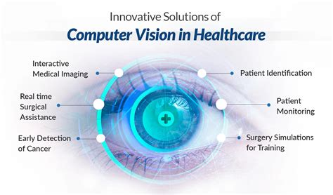 Vision Health